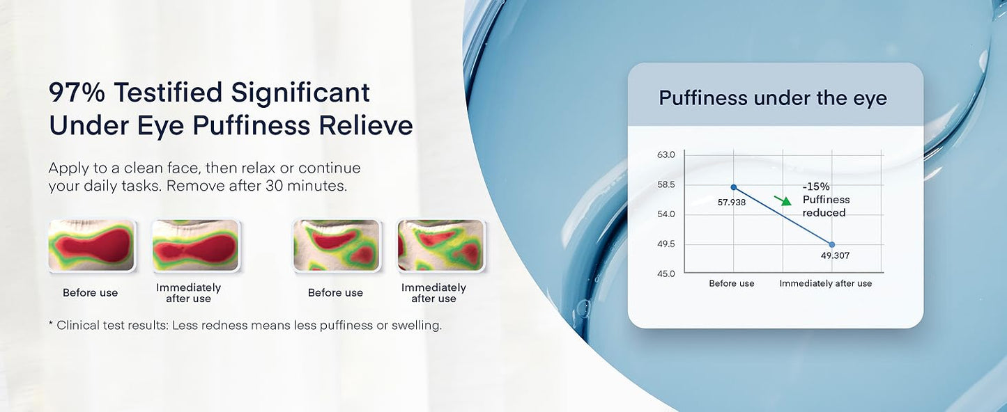 Zermet 1Zermet 1 Under Eye Patches for Dark Circles - 60 Korean Hydrogel Masks for Puffiness, Bags with Caffeine, Hyaluronic Acid, Niacinamide - Undereye Brightening, Hydrating, Anti-Wrinkle & Cooling