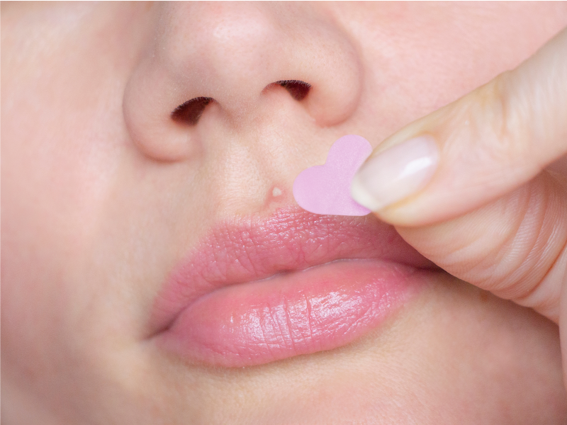 Zermet 1 grace & stella Award Winning Pore Strip - Pimple Patches for Face - Hydrocolloid Acne Patches - Absorbs Zits, Reduces Redness - Cute Patches Dermatologist-Tested, Vegan (Multishape, 36 Count)