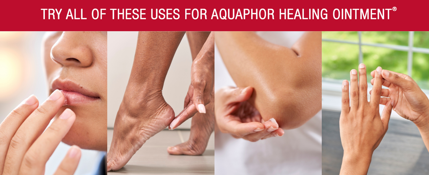 Zermet 1 Aquaphor Healing Ointment Advanced Therapy Skin Protectant Skin Care Set, Body Moisturizer for Dry Skin, Minor Cuts and Burns, Dry Cuticles, Cracked Heels, Hands and Lips, 14 Oz Jar + 1.75 Oz Tube