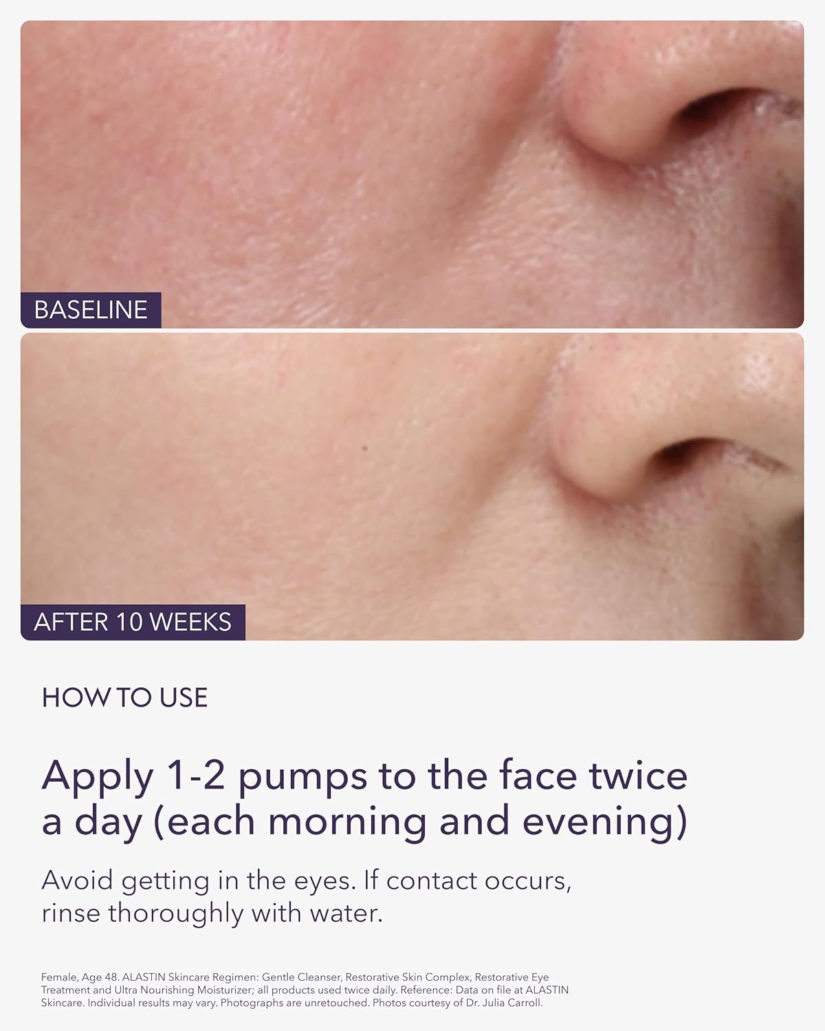 Zermet 1 Skincare Restorative Skin Complex Anti-Aging Face Serum (1 oz) | Reduce Fine Lines & Wrinkles | With Niacinamide to Improve Texture