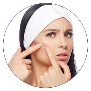 Zermet 1 SkinSmart Facial Cleanser for Acne, Targets Bacteria for Active Teenage Athletes Post Workout and Adult Acne, 8 oz Spray Bottle, Safe for Multiple Daily Uses