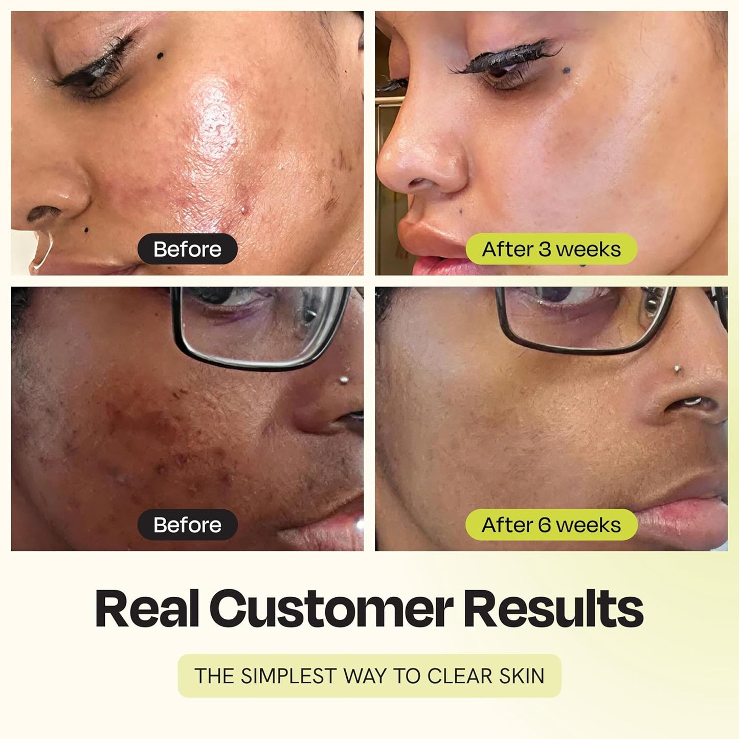 Zermet 1 Gleamin Vitamin C Clay Mask for Dark Spots, Turmeric Clay Face Mask Skin Care, Deeply Cleanses & Refines Pores, Brightens Uneven Tone and Helps Improve Post-Blemish Scarring & Texture, Up to 20 Uses