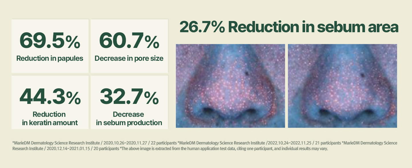 Zermet 1 Zermet 1 Calming Line Gift Box Set - Korean Facial Skin Care Essential for Daily Moisturizing, Safe on Acne Prone & Sensitive Skin, Vegan & Cruelty Free